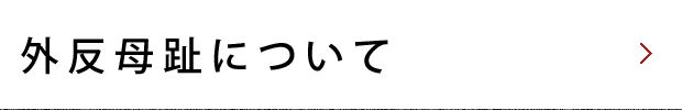 外反母趾について